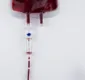 
                  UFBa faz campanha de doação de sangue para animais; confira