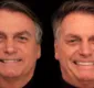 
                  Ex-presidente Jair Bolsonaro faz harmonização facial de R$ 84 mil