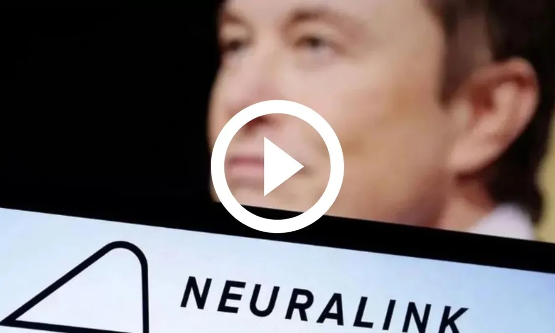 Entenda O Inédito Chip Cerebral De Elon Musk Implantado Em Humano