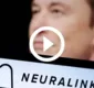 
                  Entenda o inédito chip cerebral de Elon Musk implantado em humano