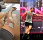 
                  No 'Dança dos Famosos', Henri Castelli revela problema na perna