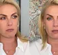 
                  Ana Hickmann abre o jogo sobre gravidez e detalha problema de saúde