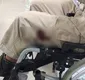 
                  Troca de tiros com suspeitos termina com PM baleado na Bahia