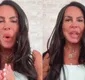 
                  Power Couple: Gretchen revela tratamento psicológico após reality show