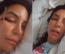Ivete Sangalo recebe alta hospitalar e explica diagnóstico