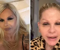 Monique Evans surge irreconhecível após cirurgia e faz revelação