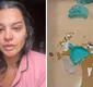 
                  Ex de Cartolouco mostra espelho quebrado em agressão: 'Toda machucada'
