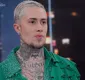 
                  MC Daniel choca com antes e depois de procedimentos: 'Fez milagre'