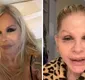 
                  Monique Evans surge irreconhecível após cirurgia e faz revelação