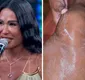
                  Dança dos Famosos: Gracyanne revela inchaço no joelho durante ensaios