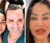 Mãe de Eduardo Costa rebate críticas sobre visual: 'Não fiz nada no rosto'