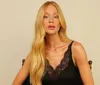 Marina Ruy Barbosa assusta com braço roxo em evento; motivo surpreende