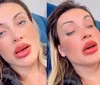 Andressa Urach desabafa após cirurgia estética: 'Medo de ficar cega'