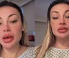 Andressa Urach expõe complicação após novo procedimento: 'Arrependida'