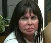 Gretchen reverte harmonização facial e emagrece 10 kg; antes e depois