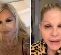 Monique Evans surge irreconhecível após cirurgia e faz revelação