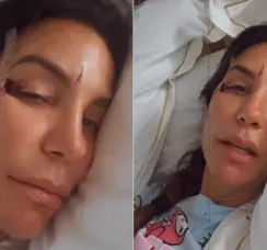 Ivete Sangalo recebe alta hospitalar e explica diagnóstico