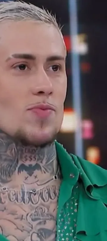 MC Daniel choca com antes e depois de procedimentos: 'Fez milagre'