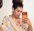 Aila Menezes mostra resultado de abdominoplastia e desabafa: ‘Vitória'