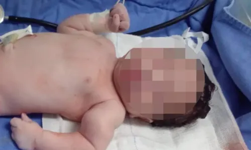 
				
					Pai acusa médicos de quebrarem braço de bebê durante parto
				
				