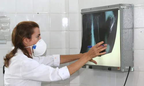
				
					Brasil registra 78 mil novos casos de tuberculose
				
				