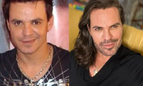 
				
					Sertanejo Eduardo Costa nega ter feito cirurgias plásticas
				
				