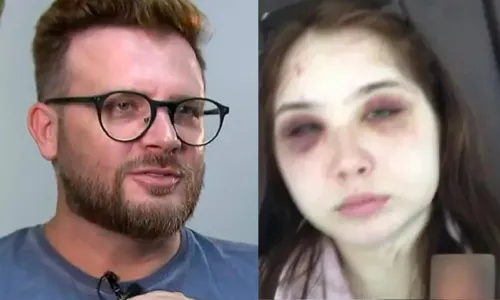 
				
					'Corrigia normalmente', diz sertanejo acusado de agredir filha
				
				