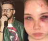 Cantor sertanejo é acusado de agredir e tentar matar filha