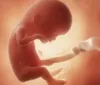 Doze semanas de gravidez: entenda como o bebê se desenvolve