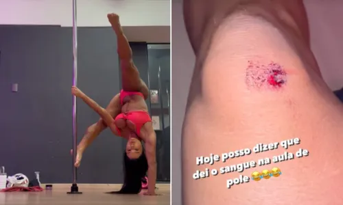 
				
					Gracyanne Barbosa fere joelho em aula de pole dance: 'Pele arrancou'
				
				