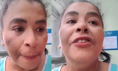 
				
					MC Katia desabafa sobre saúde após cirurgia: 'Vou perder metade do pé'
				
				