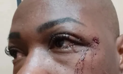 
				
					Mulher denuncia policial por agressão após discussão política na Bahia
				
				