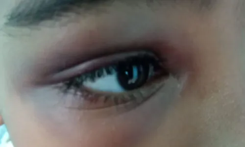 
		Polícia investiga denúncia de agressão a menino com autismo em escola