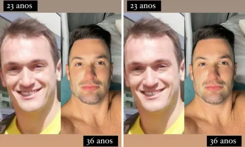 
				
					Diego Hypolito revela resultado de nova harmonização facial
				
				