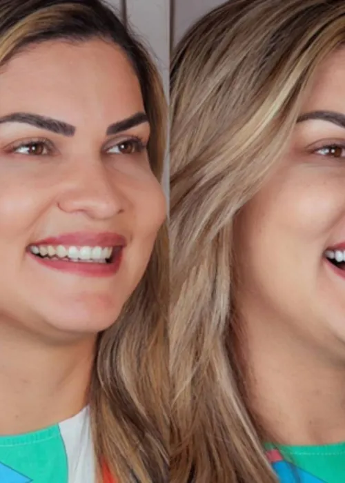 
				
					Conheça Amanda Honorato, dentista que transforma sorrisos dos baianos
				
				