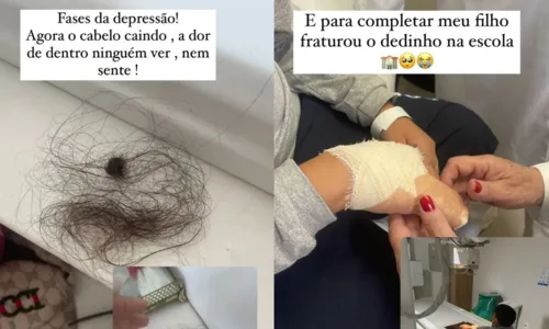 
				
					Esposa de Frank Aguiar desabafa na web após sofrer com doença rara na pele
				
				