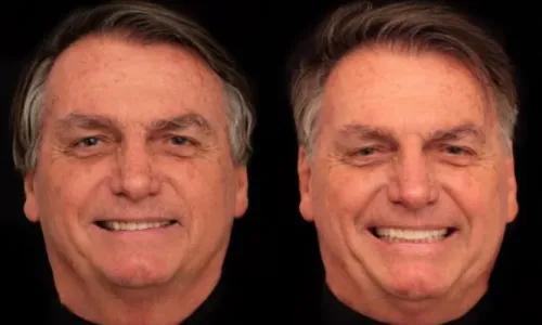 
				
					Ex-presidente Jair Bolsonaro faz harmonização facial de R$ 84 mil
				
				