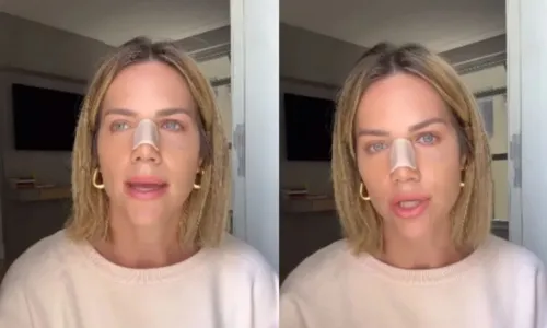
				
					Giovanna Ewbank explica motivo de cirurgia no nariz: 'Estava tendo apneia'
				
				