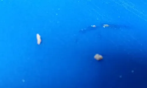 
				
					Pais denunciam escola em Salvador por larvas em merenda
				
				