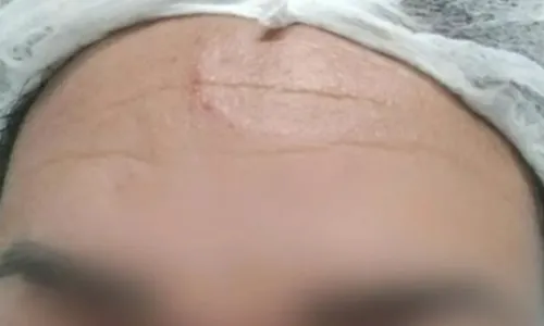 
				
					Técnica em enfermagem é agredida por casal em situação de rua em Salvador
				
				