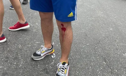 
				
					Torcedores do Boca Juniors ficam feridos após invasão no Maracanã
				
				