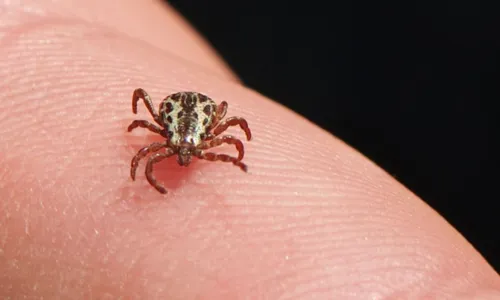 
				
					Campinas confirma mais duas mortes por febre maculosa
				
				