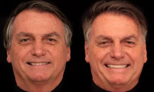 
				
					Ex-presidente Jair Bolsonaro faz harmonização facial de R$ 84 mil
				
				