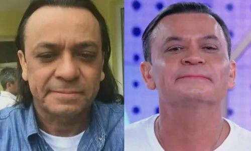 
				
					Frank Aguiar passa por harmonização facial; confira transformação
				
				