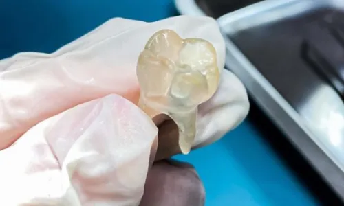 
				
					Impressão 3D na odontologia: baianos inovam modo ensino na Bahia
				
				