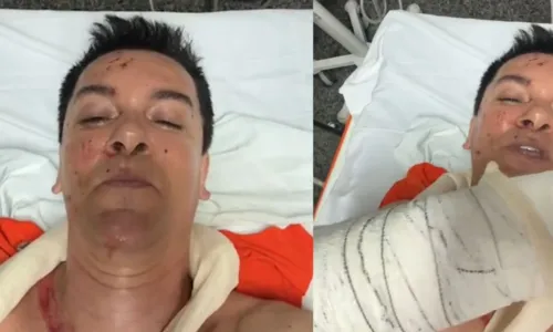 
				
					Regis Danese passa por cirurgia de emergência após grave acidente; VÍDEO
				
				