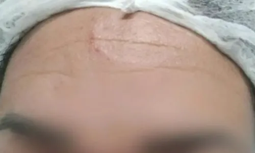 
				
					Técnica em enfermagem é agredida por casal em situação de rua em Salvador
				
				