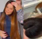 
                  Maiara, da dupla com Maraisa, é diagnosticada com alopecia