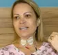 
                  Sol Almeida faz tratamento para recuperar voz: 'Lesão nas cordas'