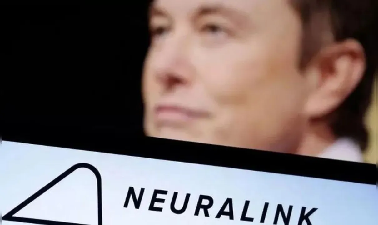 Startup de Elon Musk faz o primeiro implante de chip em cérebro humano